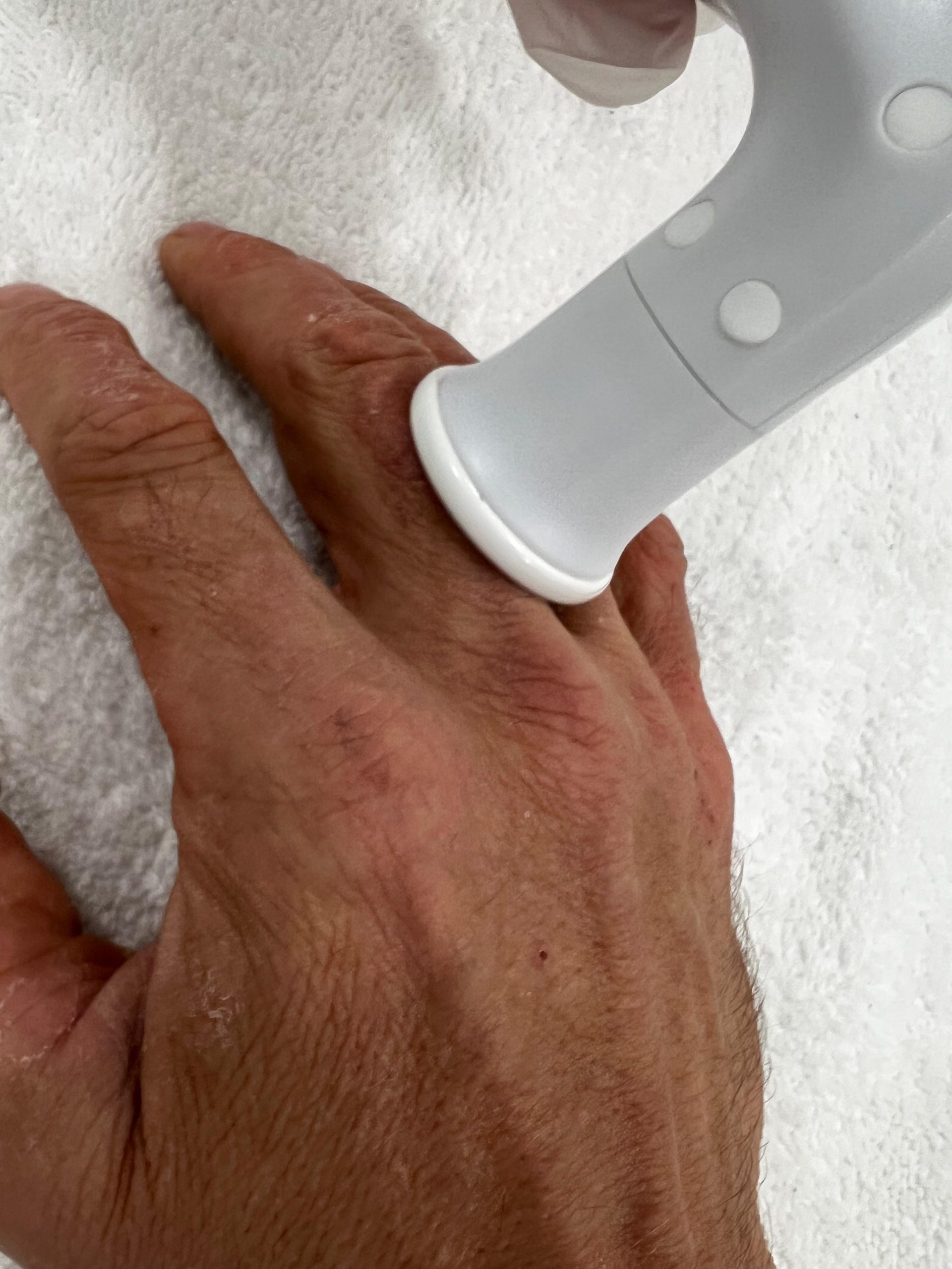 Tratamiento dermatitis Madrid