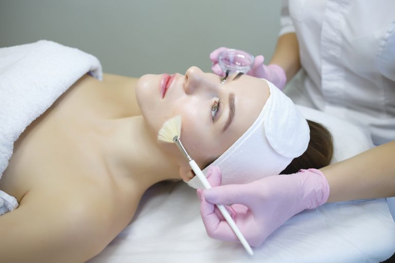 peeling químico